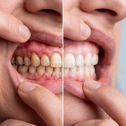 Dentixor