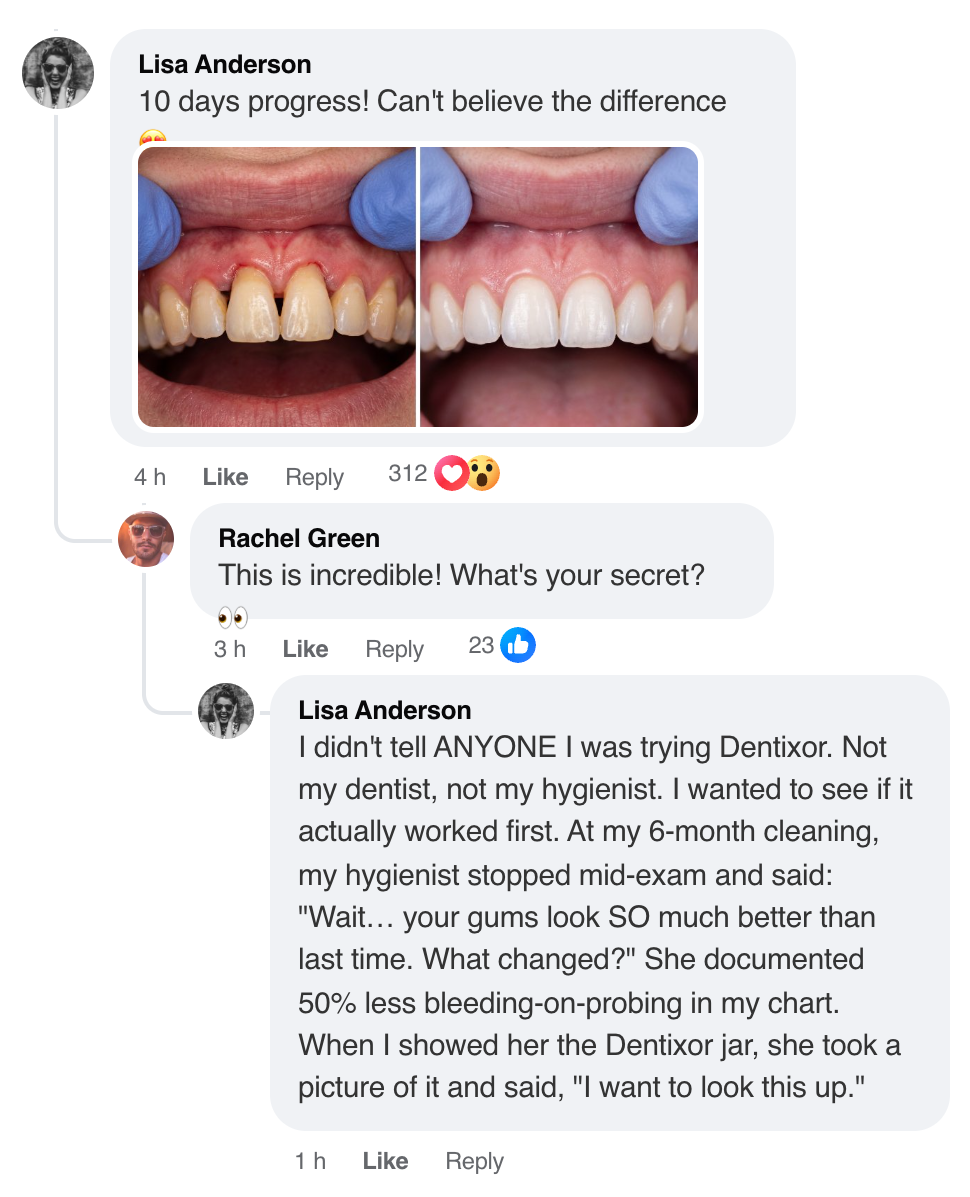 Dentixor™