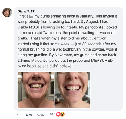 Dentixor