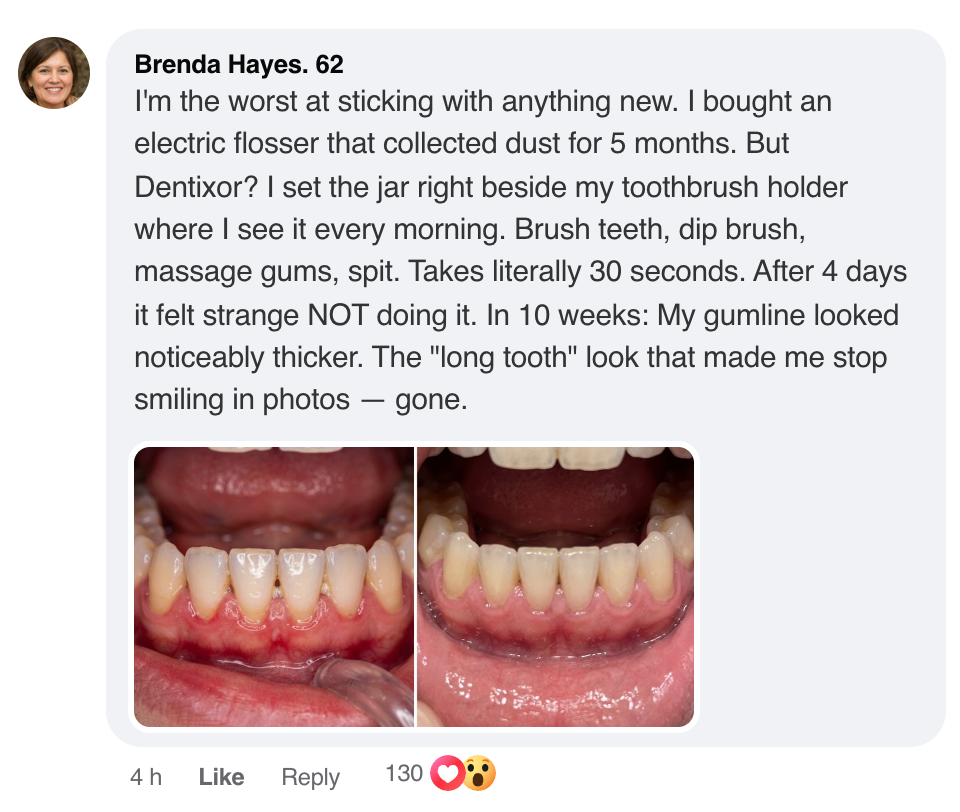 Dentixor™